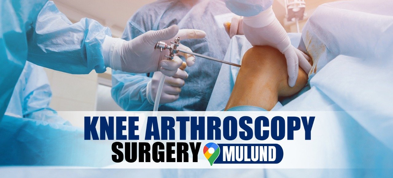 Knee Arthroscopy surgeon in mulund