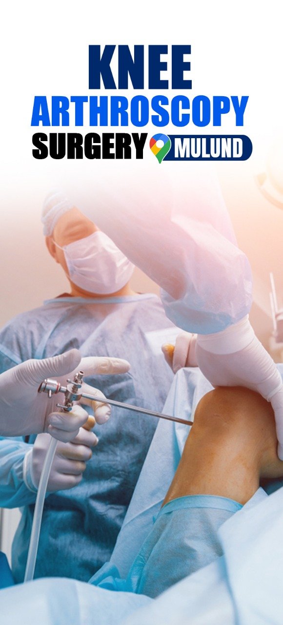 Knee Arthroscopy surgeon in mulund
