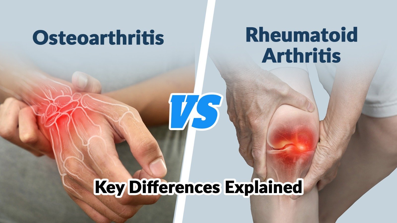 Osteoarthritis Vs Rheumatoid Arthritis Key Differences Explained